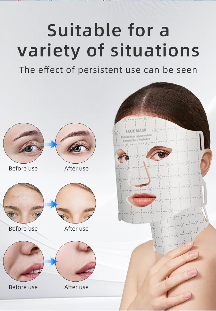 oriday Pure White Seven-Color LED Mask + Neck Light Therapy | Three energy levels for skin rejuvenation and whitening | Food-grade silicone for perfect fit | Home beauty device